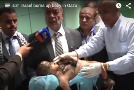 Israel burns baby